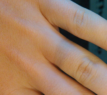 How Can You Stop a Ring From Turning Your Finger Green?